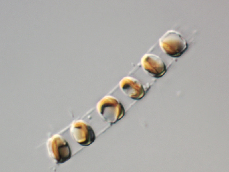 Marine Microalga Shows Promise for Protecting Bones by Calming the Immune System